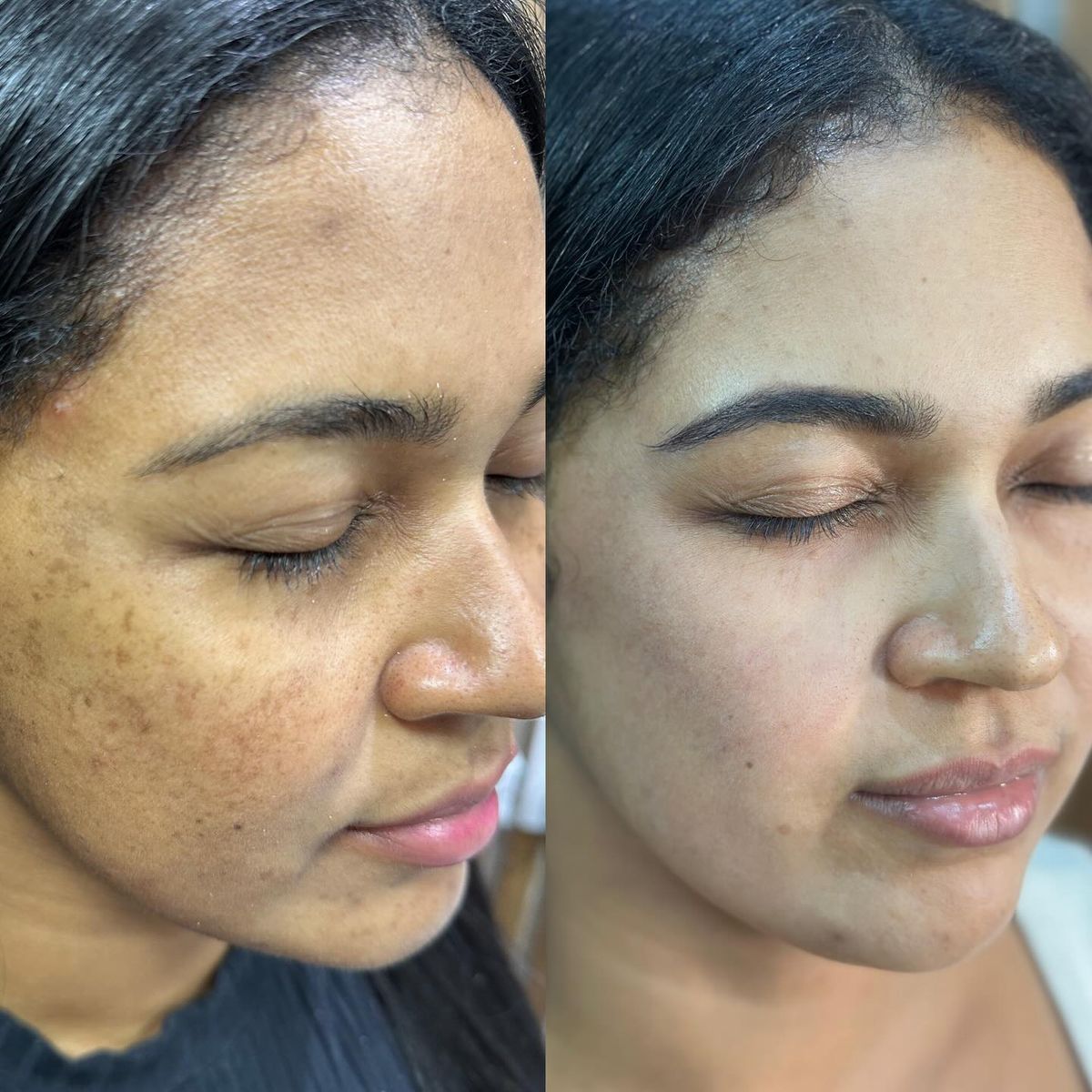 Crema Vitamina C Booster · Piel Sin Manchas y Luminosa
