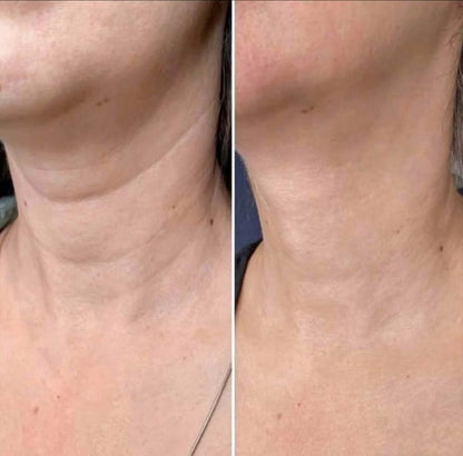 Crema de Colágeno para el Cuello PDRN con Masajeador