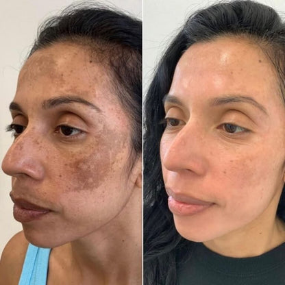 Crema Vitamina C Booster · Piel Sin Manchas y Luminosa
