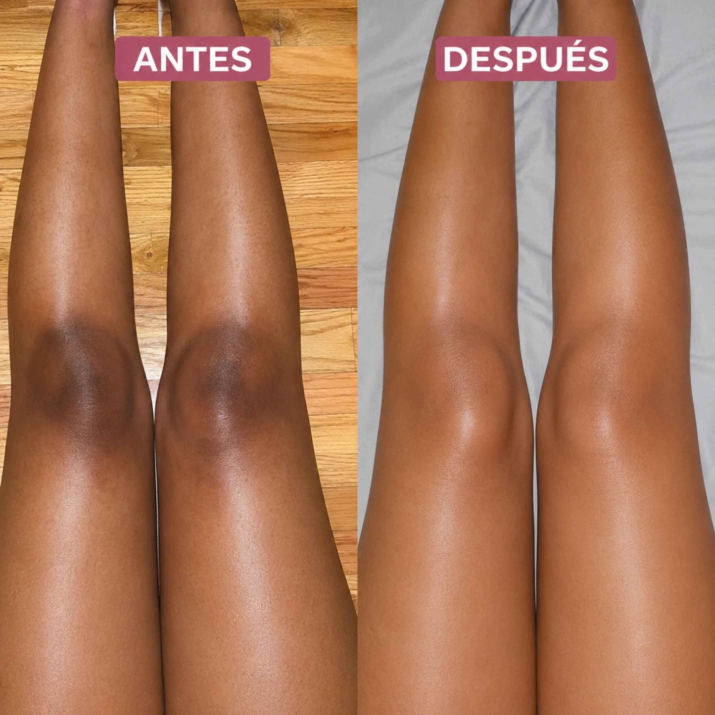 Crema Vitamina C Booster · Piel Sin Manchas y Luminosa