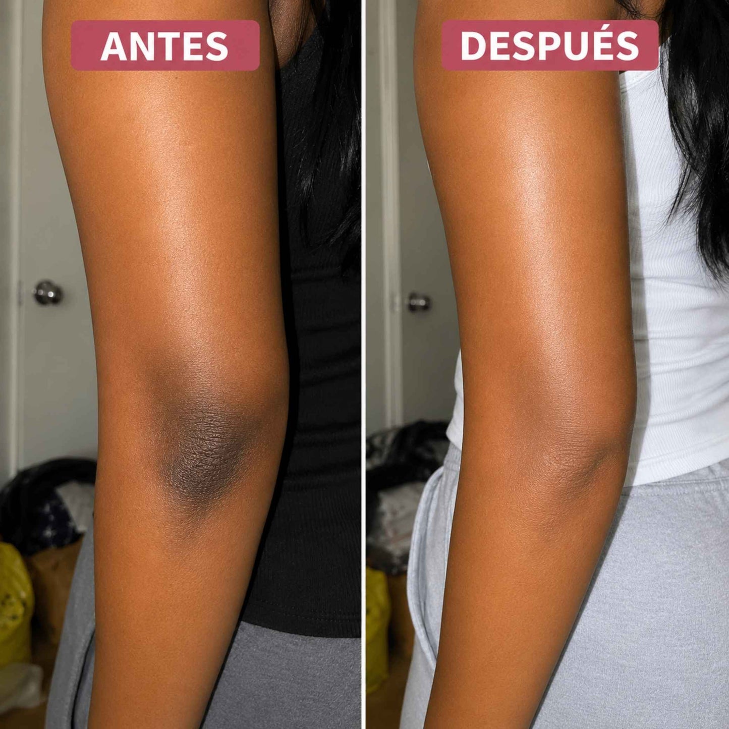 Crema Vitamina C Booster · Piel Sin Manchas y Luminosa