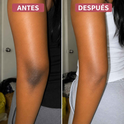 Crema Vitamina C Booster · Piel Sin Manchas y Luminosa