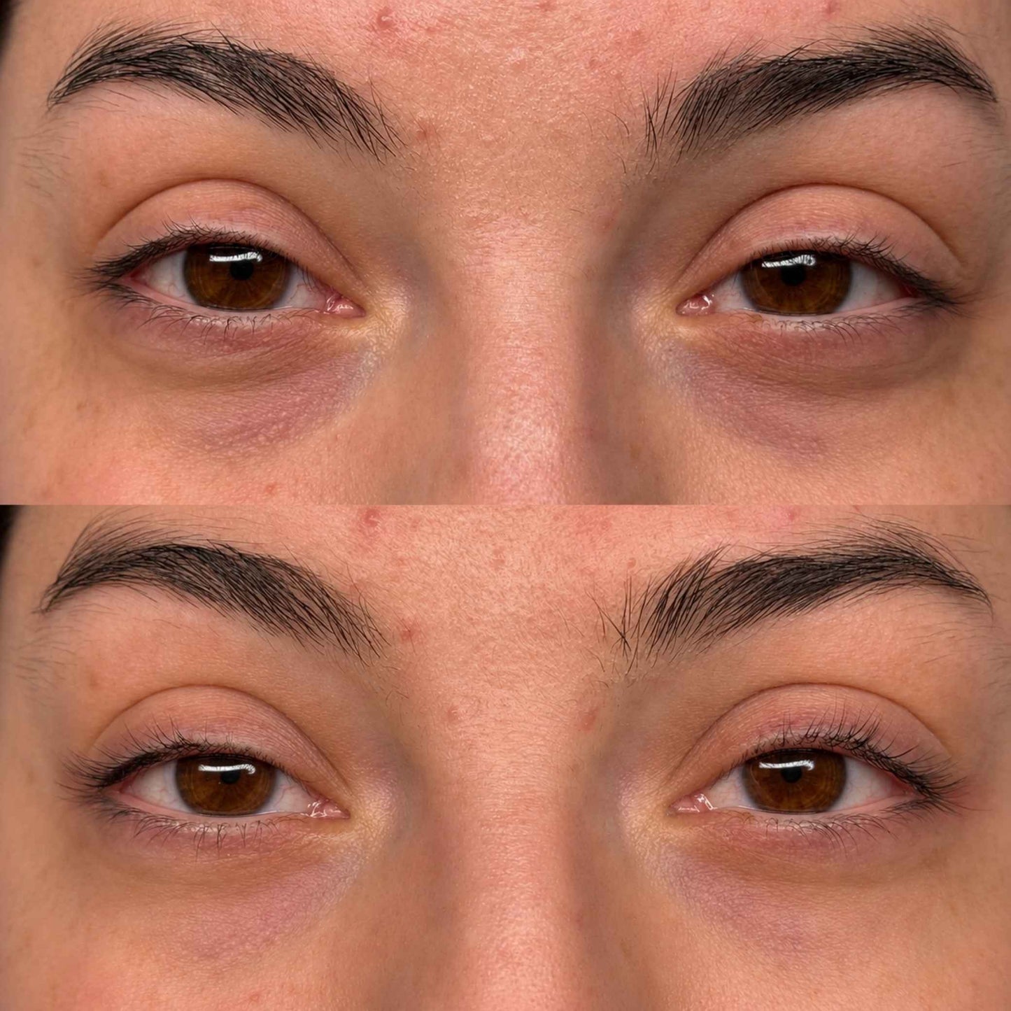 Crema Cemenrette con calcio para las ojeras