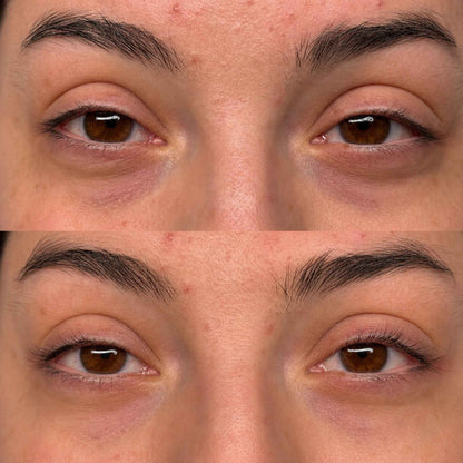 Crema Cemenrette con calcio para las ojeras