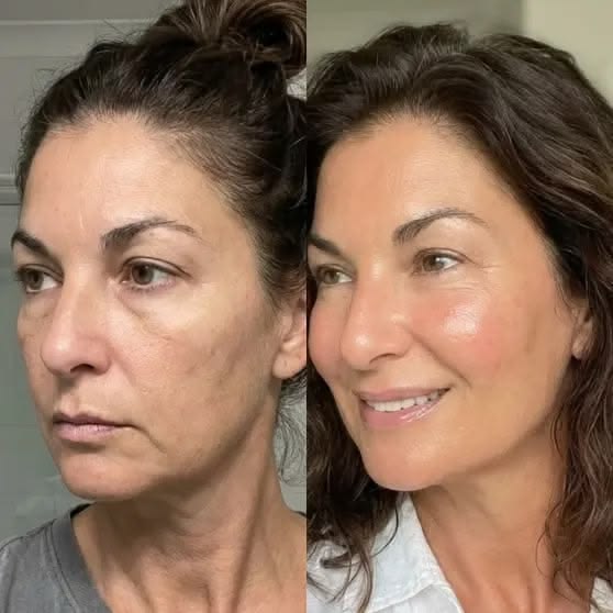 Mascarilla Coreana PDRN ADN Salmón