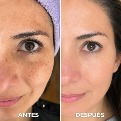 Pads JiYu Despigmentantes y Aclarantes Coreanos