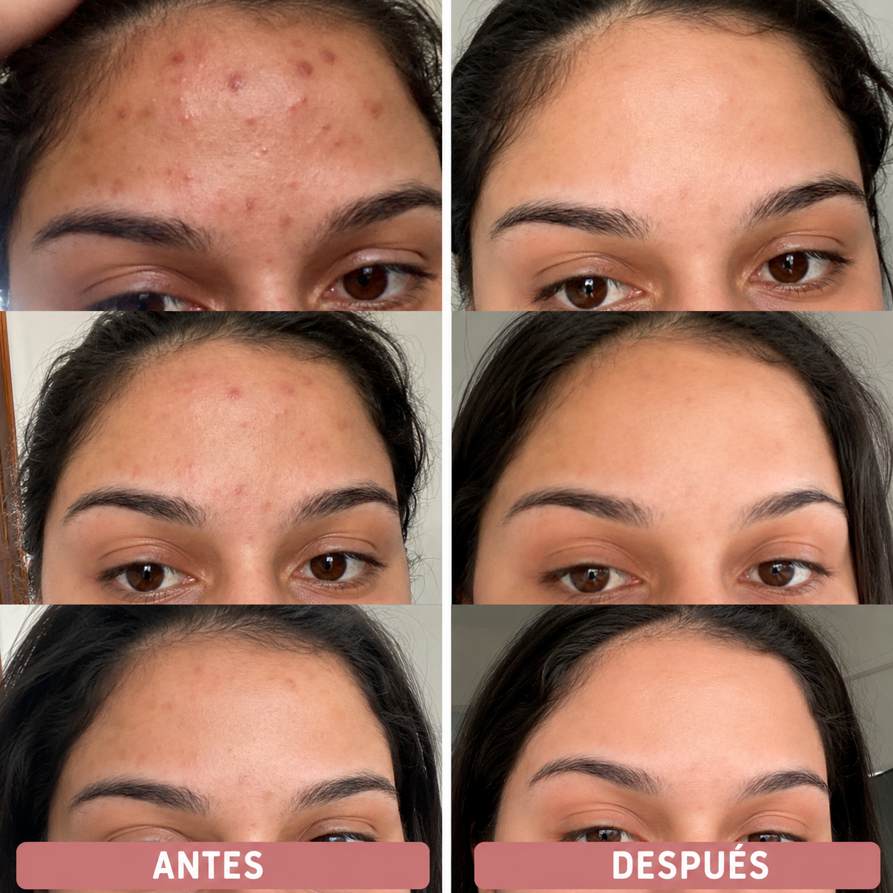 Pads JiYu Despigmentantes y Aclarantes Coreanos