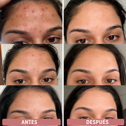 Pads JiYu Despigmentantes y Aclarantes Coreanos