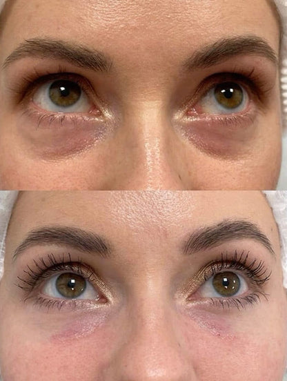 Parches Oculares de Colágeno y Péptido PDRN