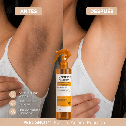 Spray Exfoliante Corporal · Ácido Kójico + Cúrcuma | Piel suave, pareja y luminosa