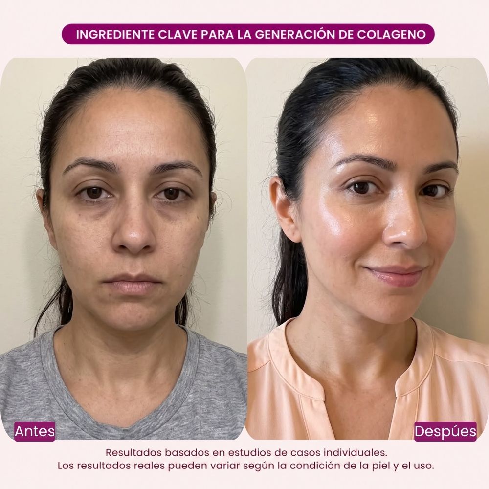 Set Reafirmante Integral Potenciador de Colágeno