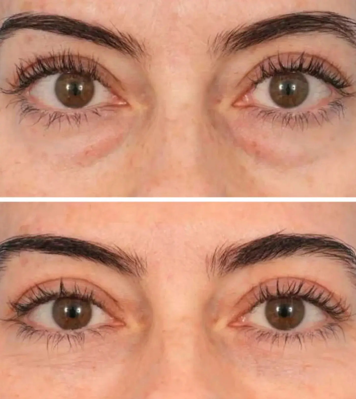 Tensor instantáneo que desinflama bolsas y camufla ojeras