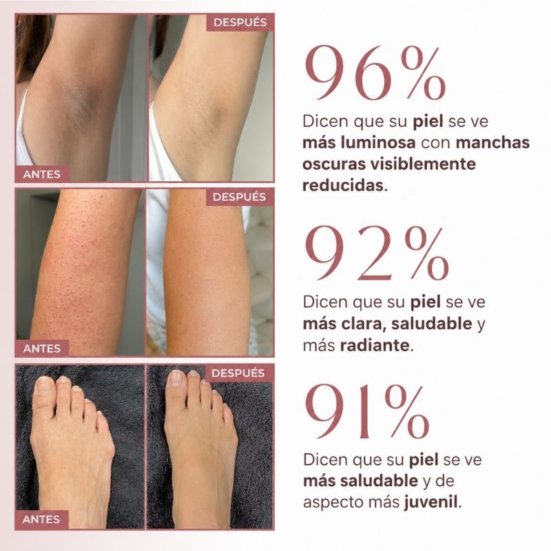 Spray Exfoliante Corporal · Ácido Kójico + Cúrcuma