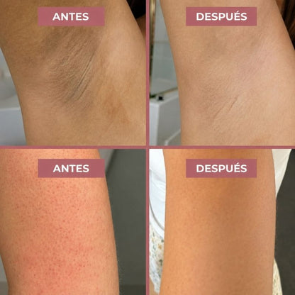 Spray Exfoliante Corporal · Ácido Kójico + Cúrcuma