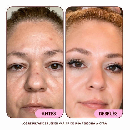 Crema NAD+ Antiedad · Hidratación Profunda