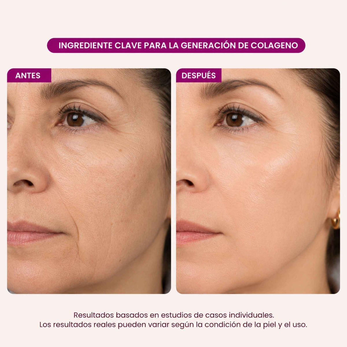 Set Reafirmante Integral Potenciador de Colágeno