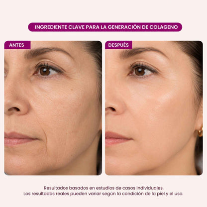 Set Reafirmante Integral Potenciador de Colágeno