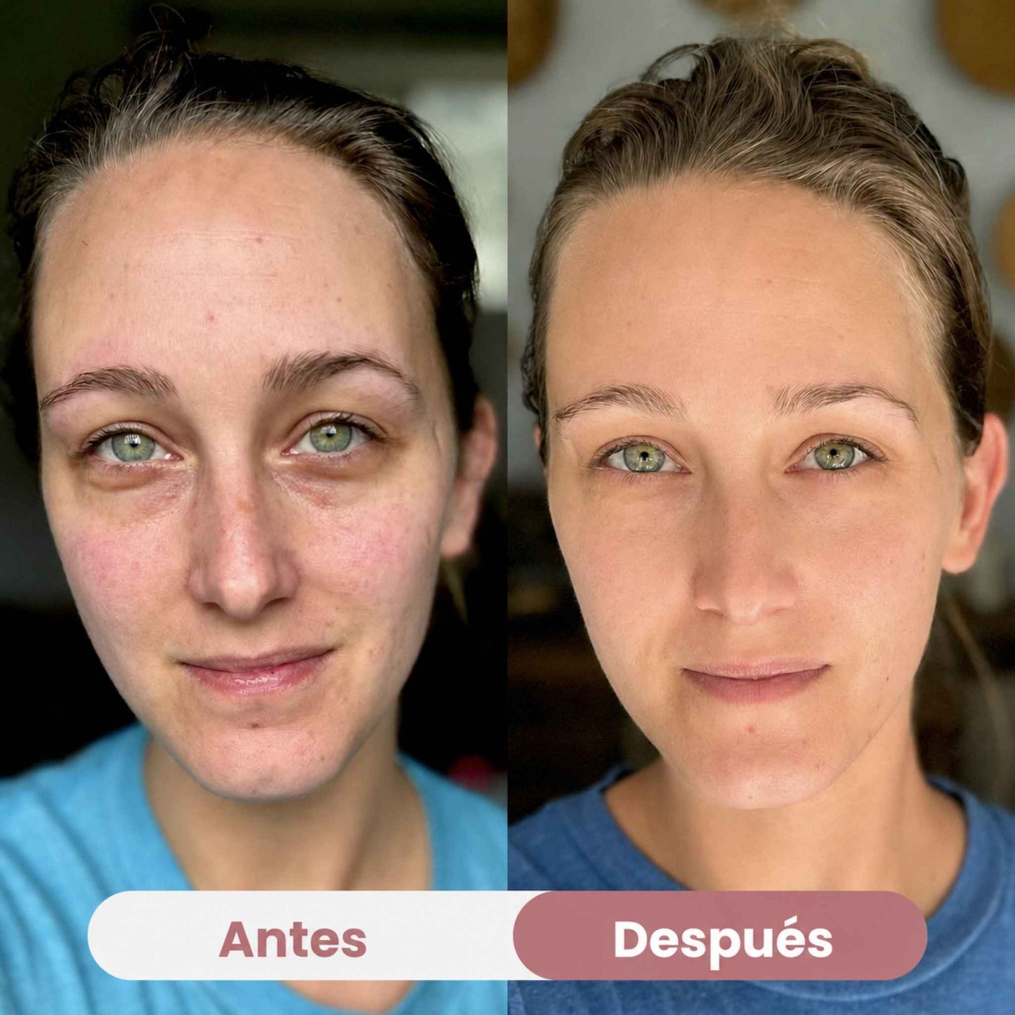 Mascarilla Ocular de Colágeno Peptidico | Anti-ojeras
