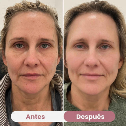 Mascarilla Ocular de Colágeno Peptidico | Anti-ojeras