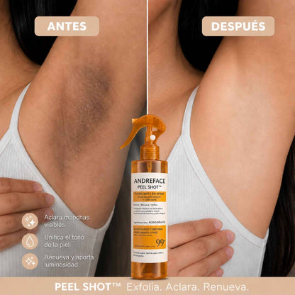 Spray Exfoliante Corporal · Ácido Kójico + Cúrcuma | Piel suave, pareja y luminosa