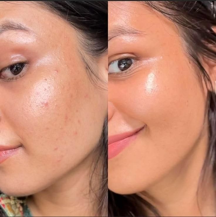 Crema Vitamina C Booster · Piel Sin Manchas y Luminosa