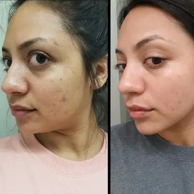 Crema Vitamina C Booster · Piel Sin Manchas y Luminosa